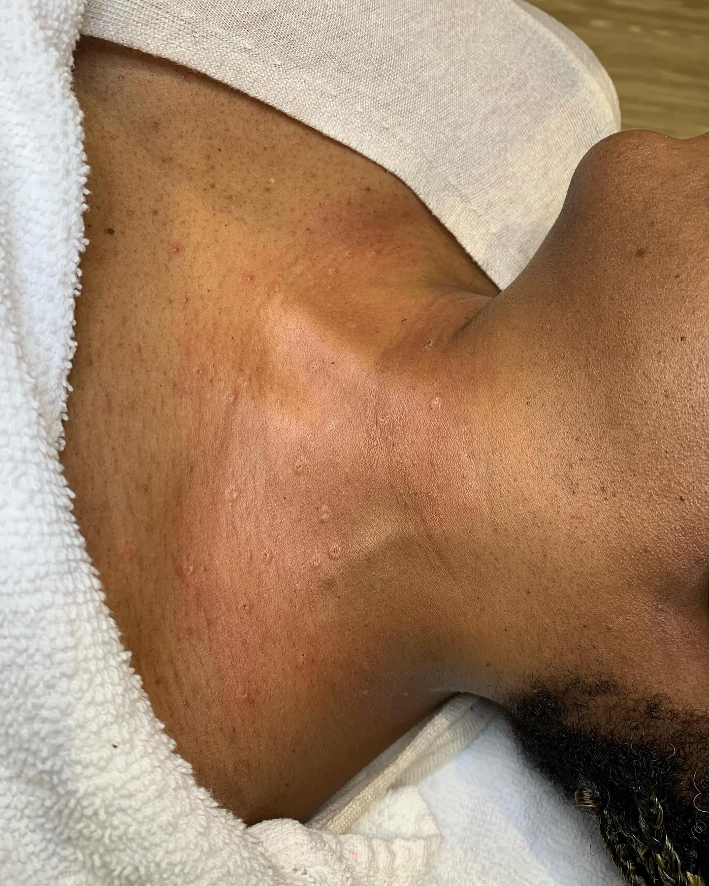 Polished Laser and Skin Aesthetics