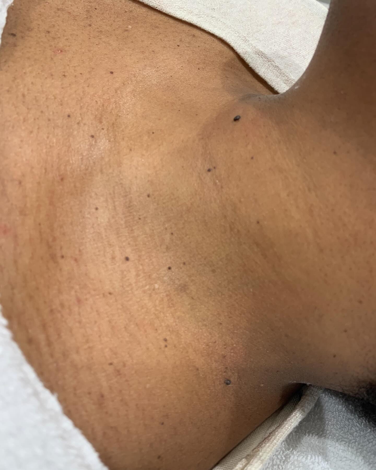 Polished Laser and Skin Aesthetics