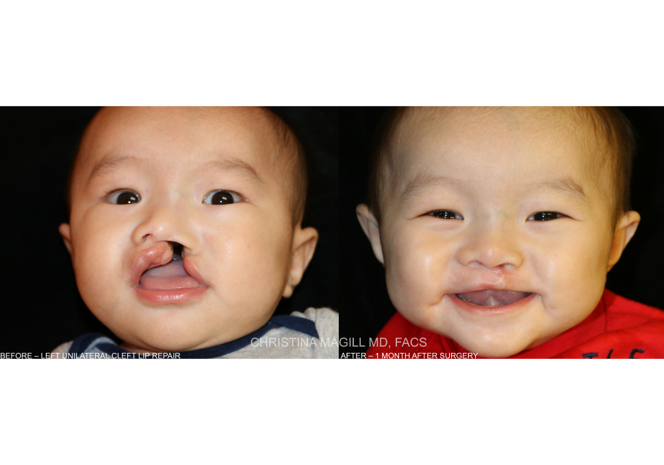 Alaska Facial Plastic Surgery & ENT