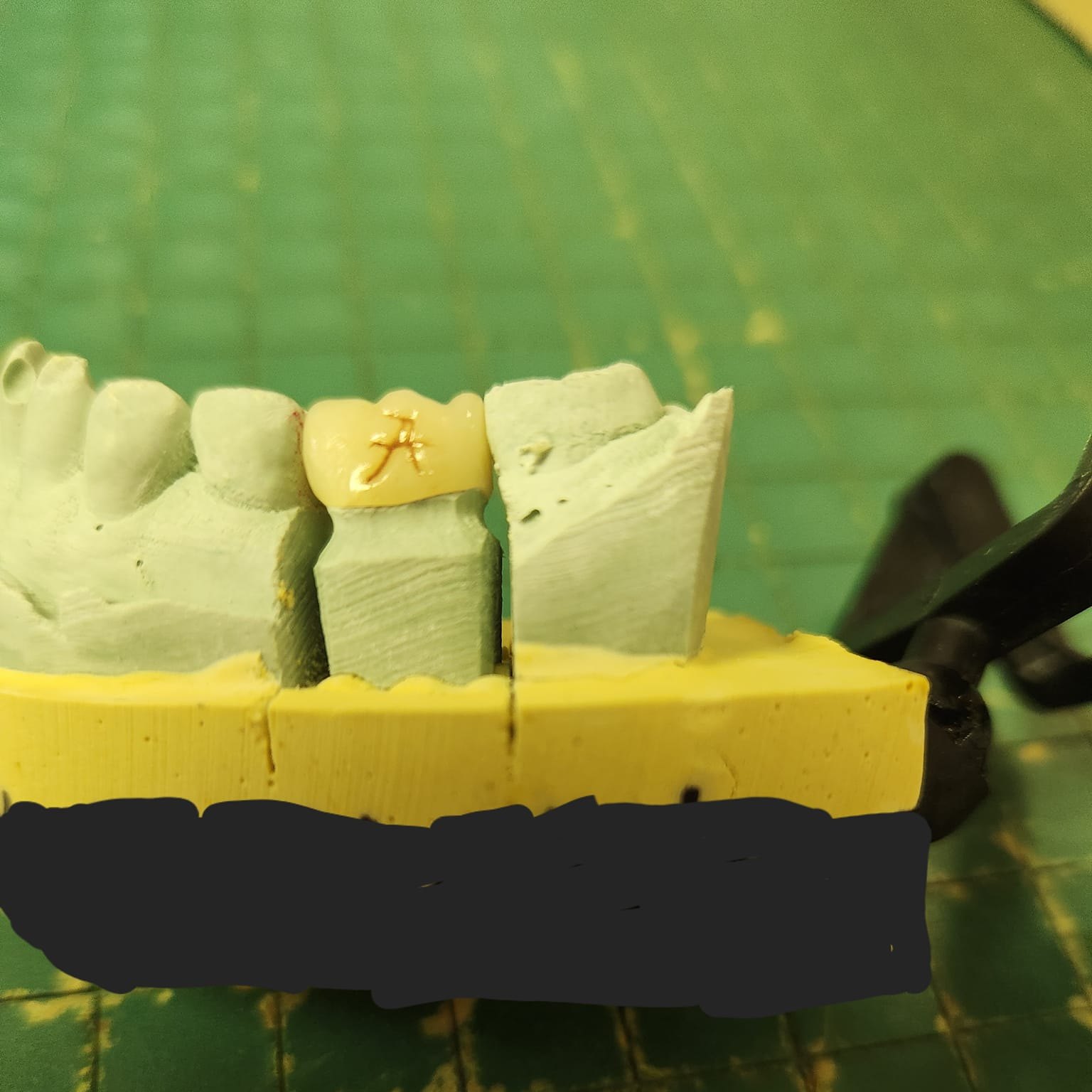 Martin Dental Laboratory 114 S Lena St, Dothan Alabama 36301