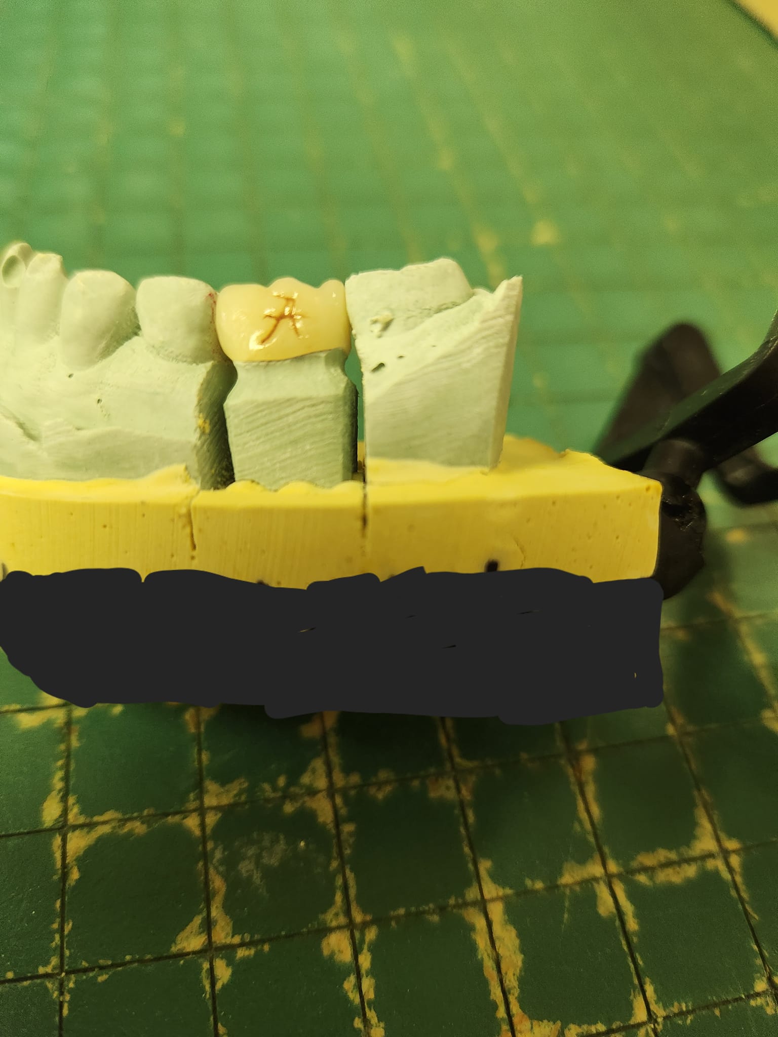 Martin Dental Laboratory