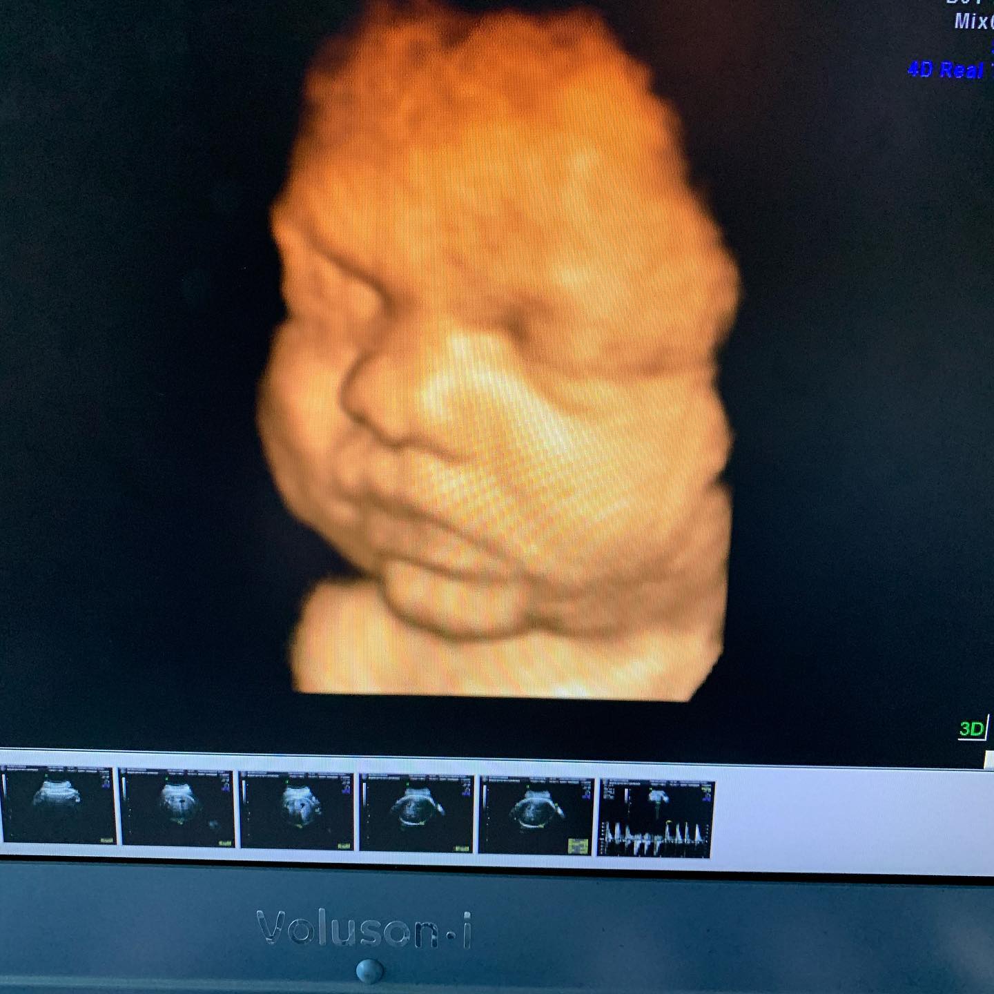 Precious Predictions LLC