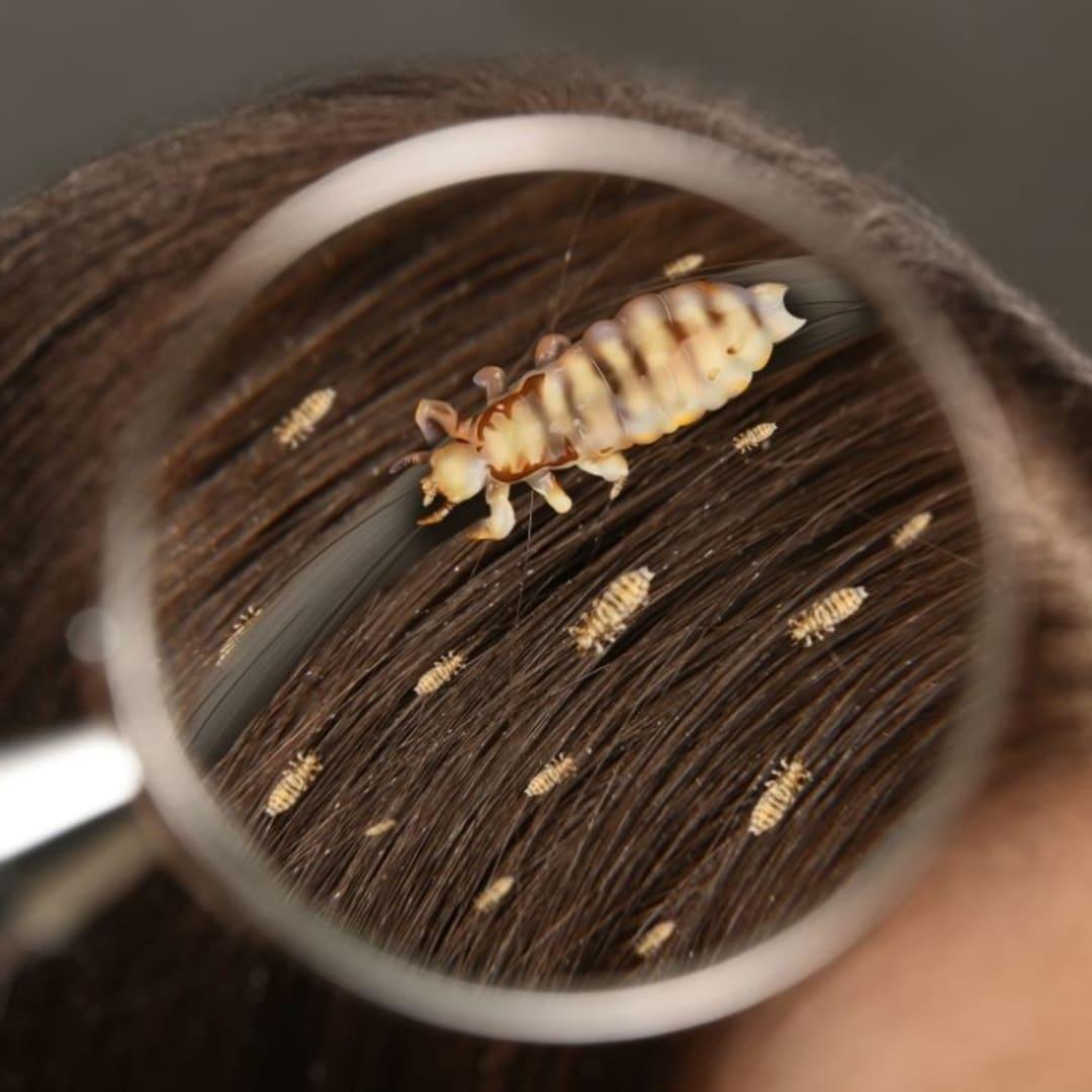 Lice Clinics Arizona