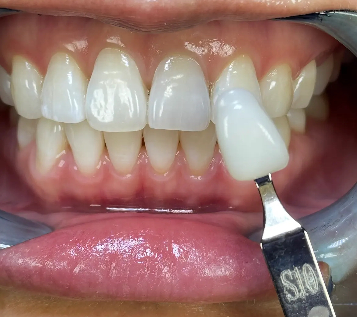 Aviator Dental Hygiene 20020 84 Ave A110, Langley Twp British Columbia 