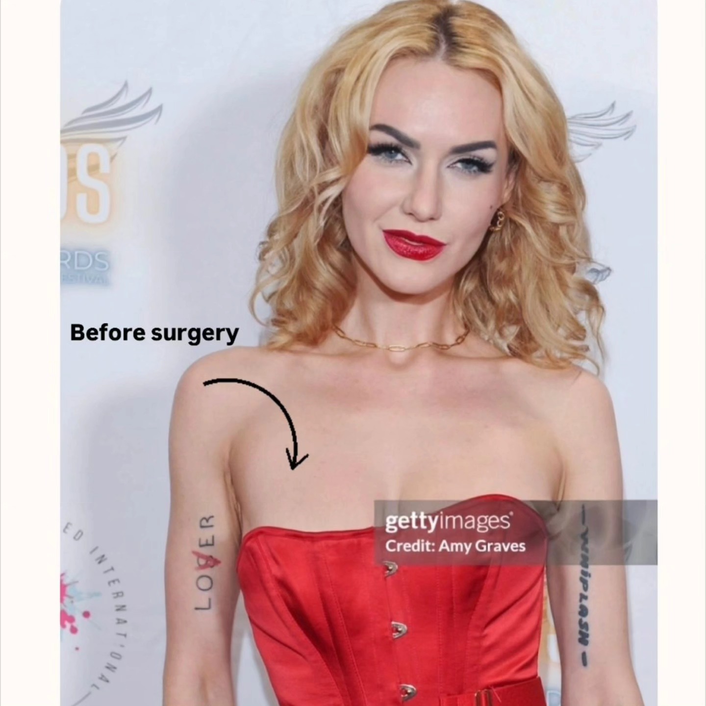 Hakimi Plastic Surgery