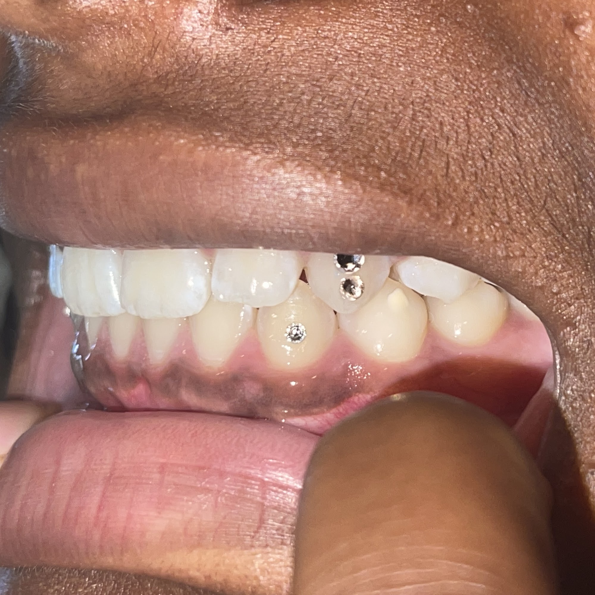 BF SMILE STUDIO 6100 Fair Oaks Blvd Suite C, Carmichael California 95608