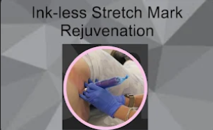 Photo credit: bestprosintown