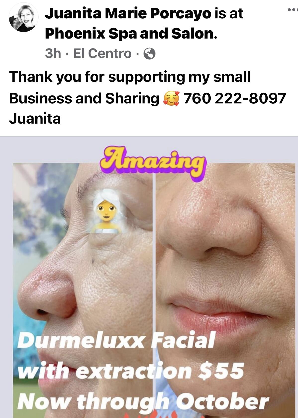 Photo credit: nextdoor