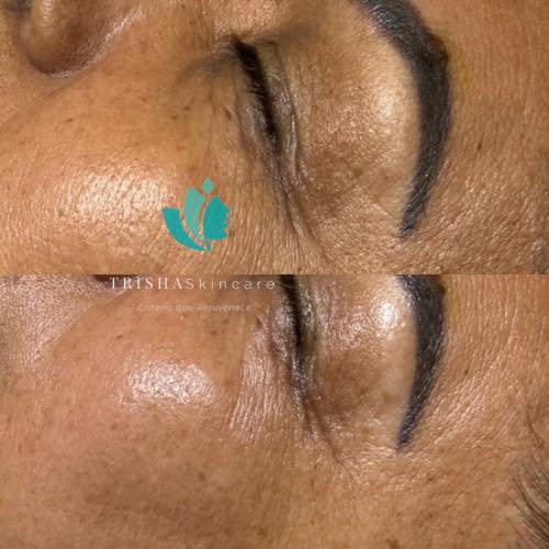 Esthetician & Micropigmentation TRISHA