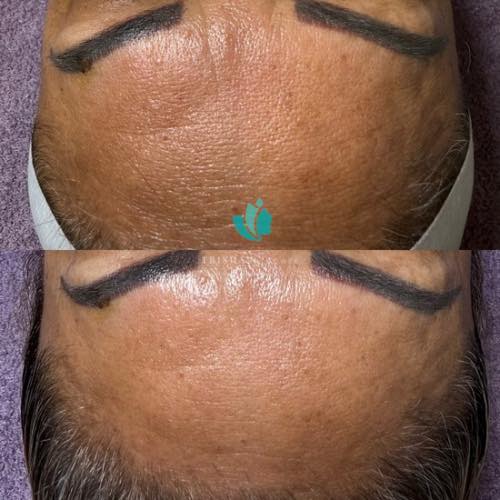 Esthetician & Micropigmentation TRISHA