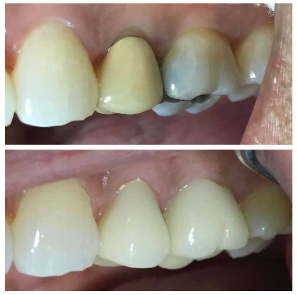 Phuong K Tran DDS Inc, New Leaf Dentistry