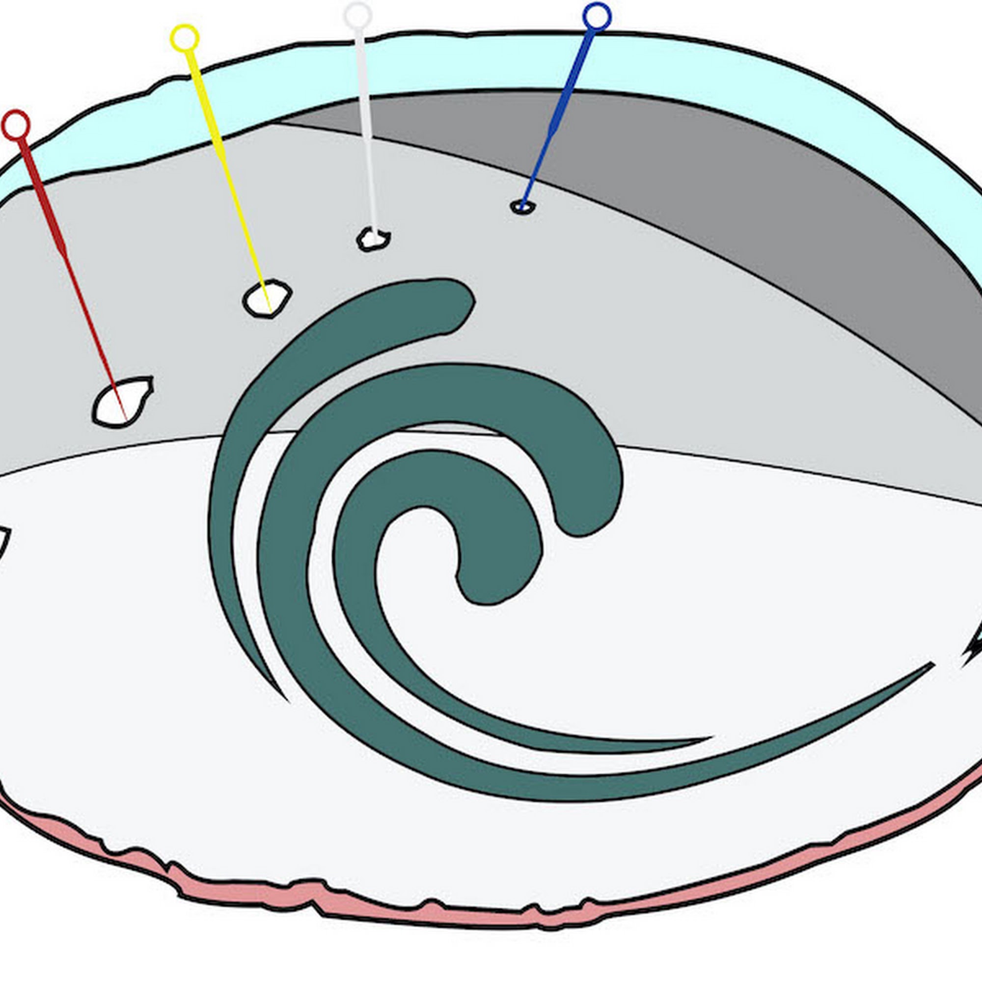 Watsonville Acupuncture