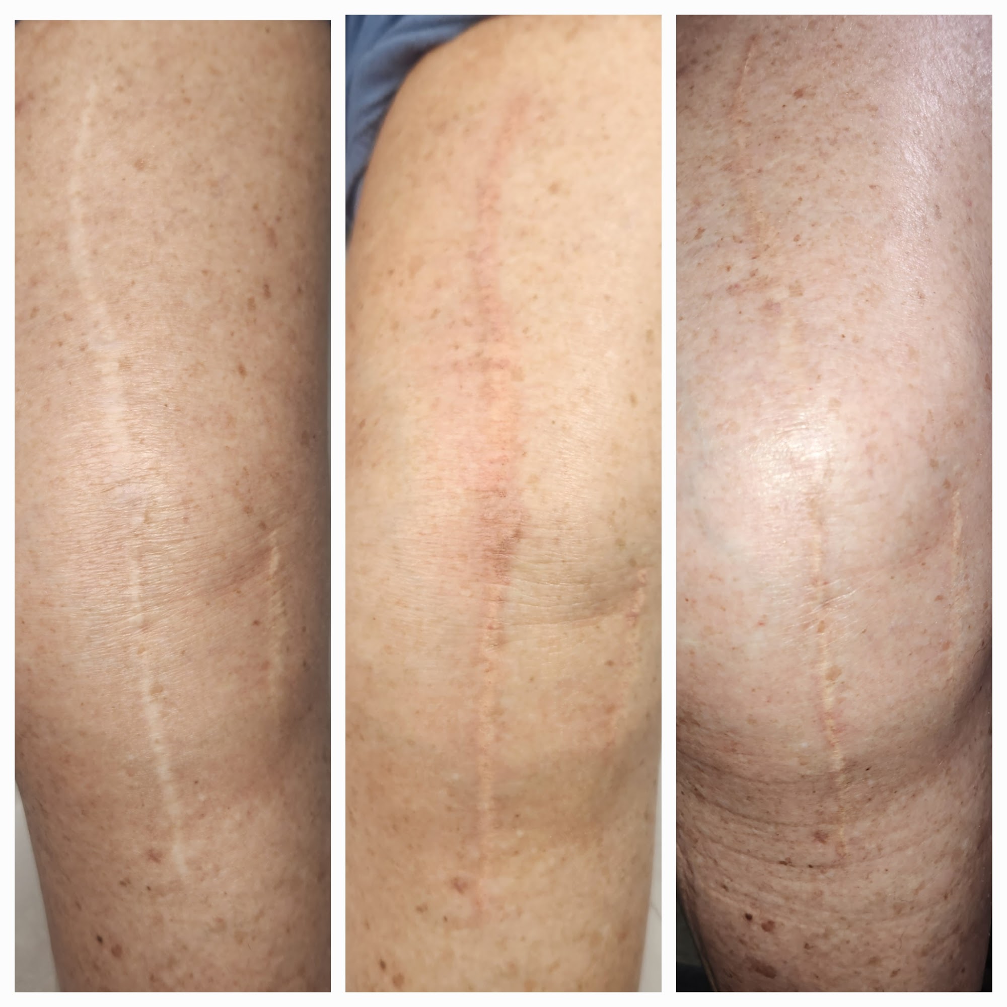 J'adore Aesthetics LLC- Medical Tattoo