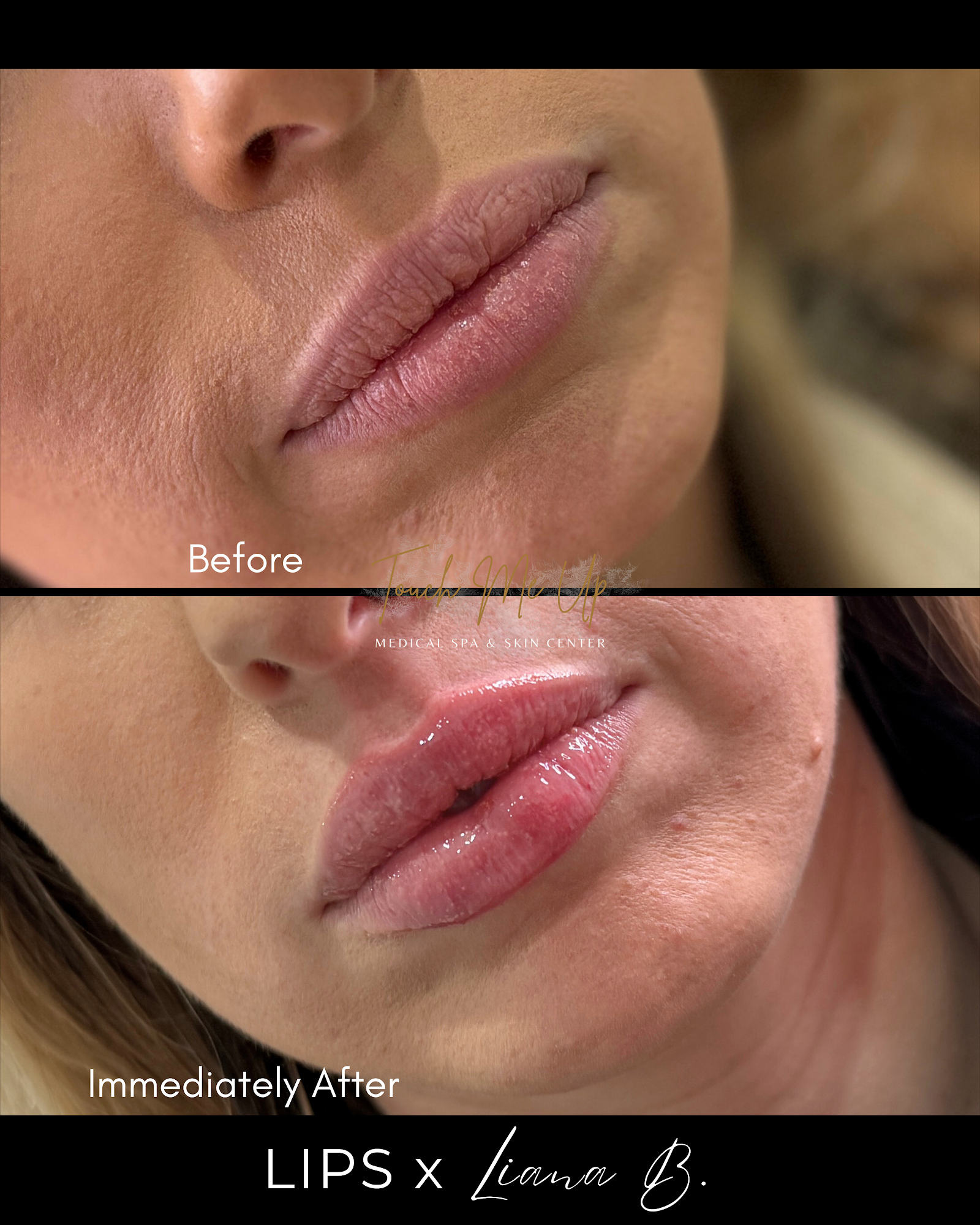 Touch Me Up Medical Spa & Skin Center