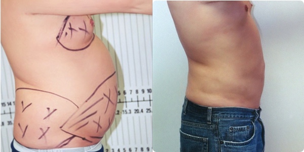 SD Body Contouring 8690 Center Drive C, La Mesa, CA 91942