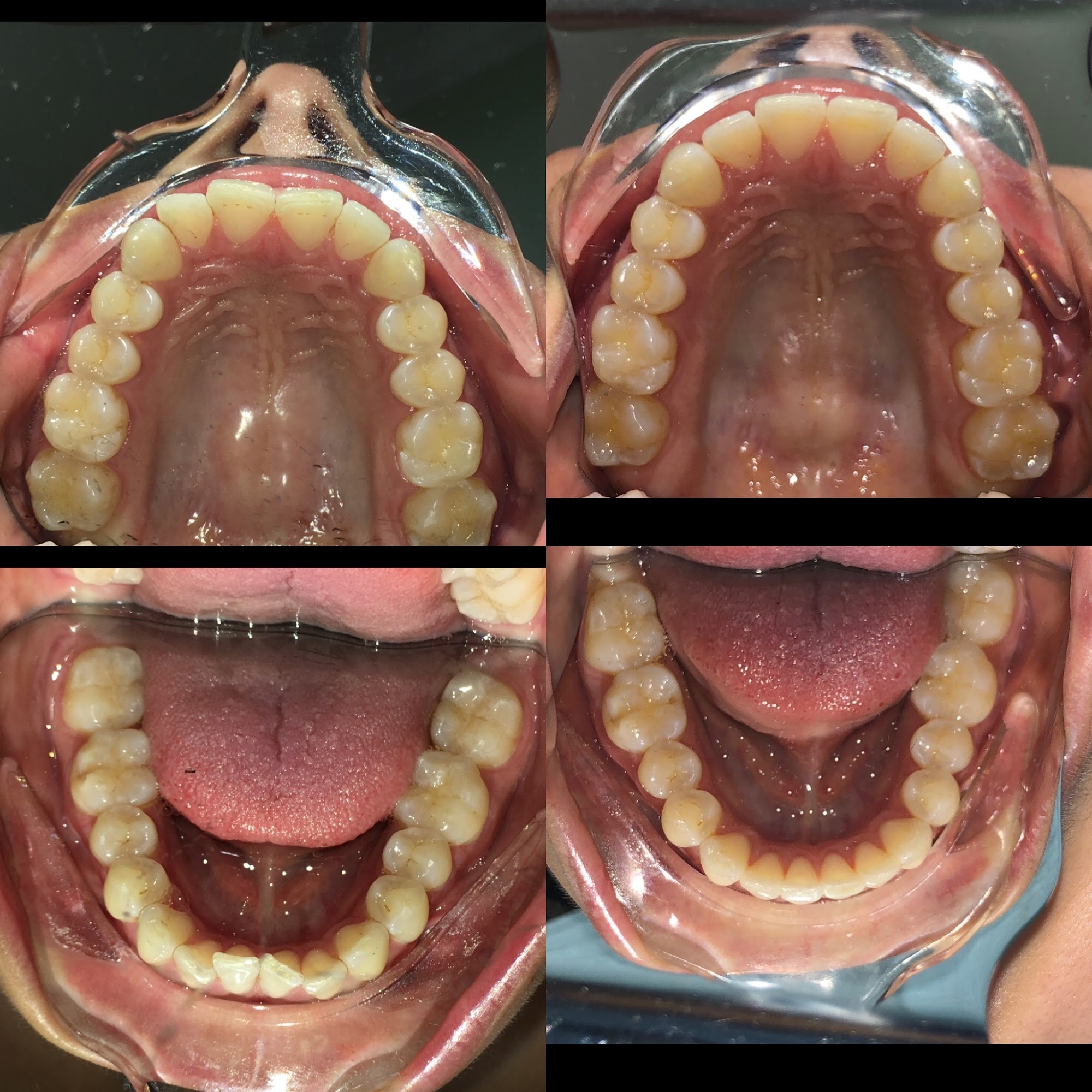 Westwood Village Smiles