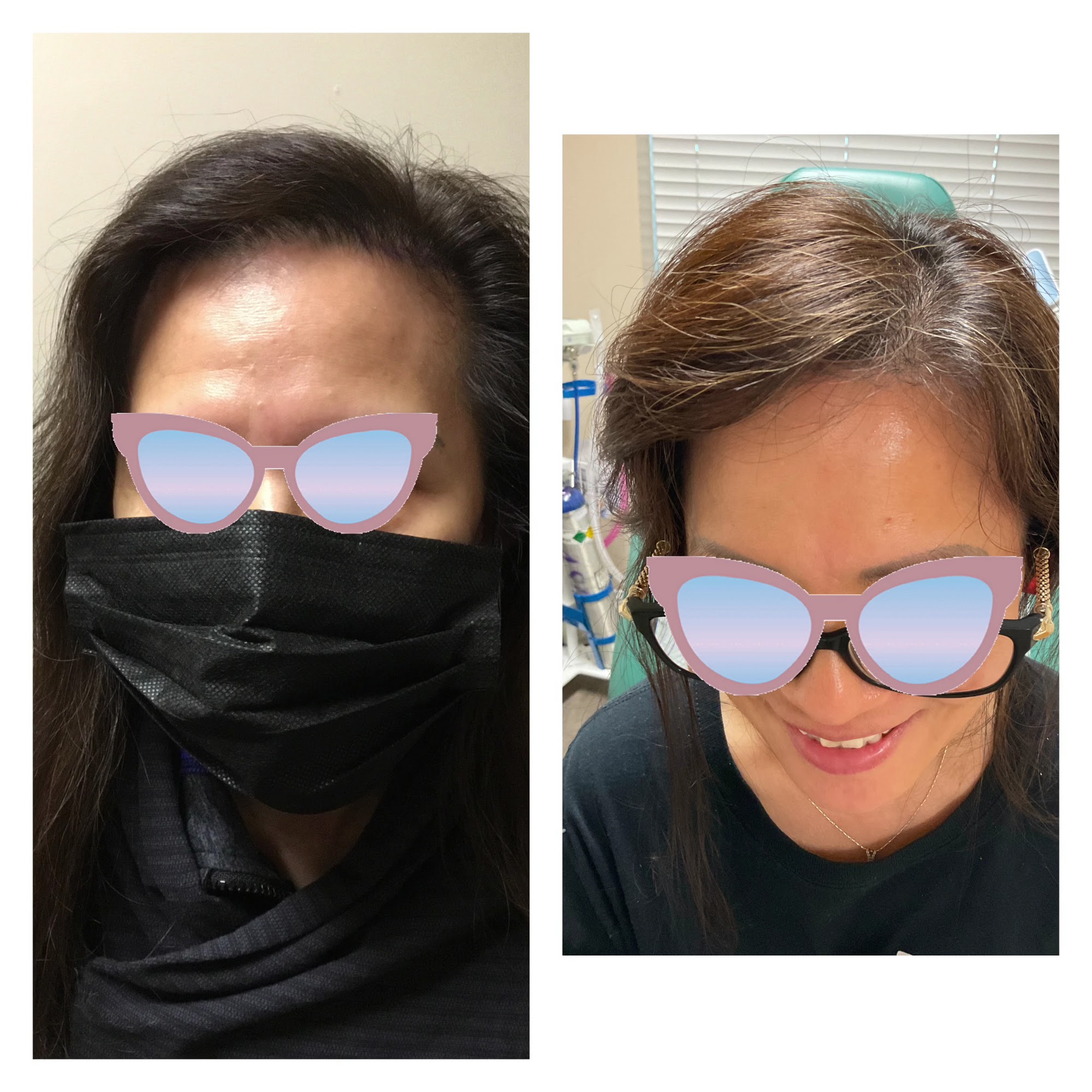 Le Aesthetic 995 Montague Expy #114, Milpitas California 95035