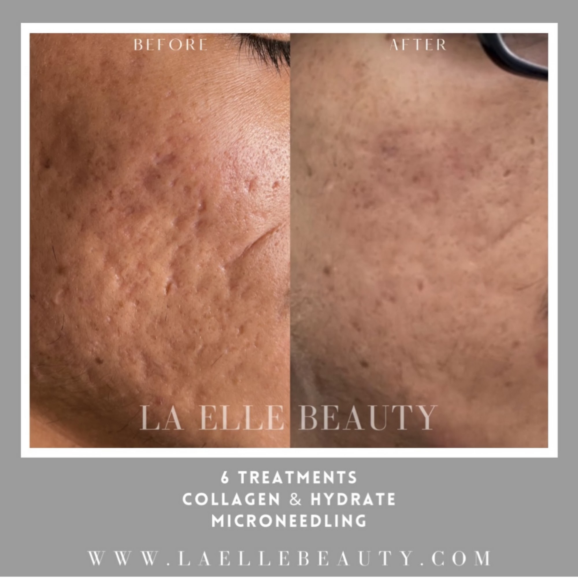 LC INK & SKIN LC INK & SKIN at Sola Salons, 806 W Beverly Blvd Suite 7, Montebello California 90640