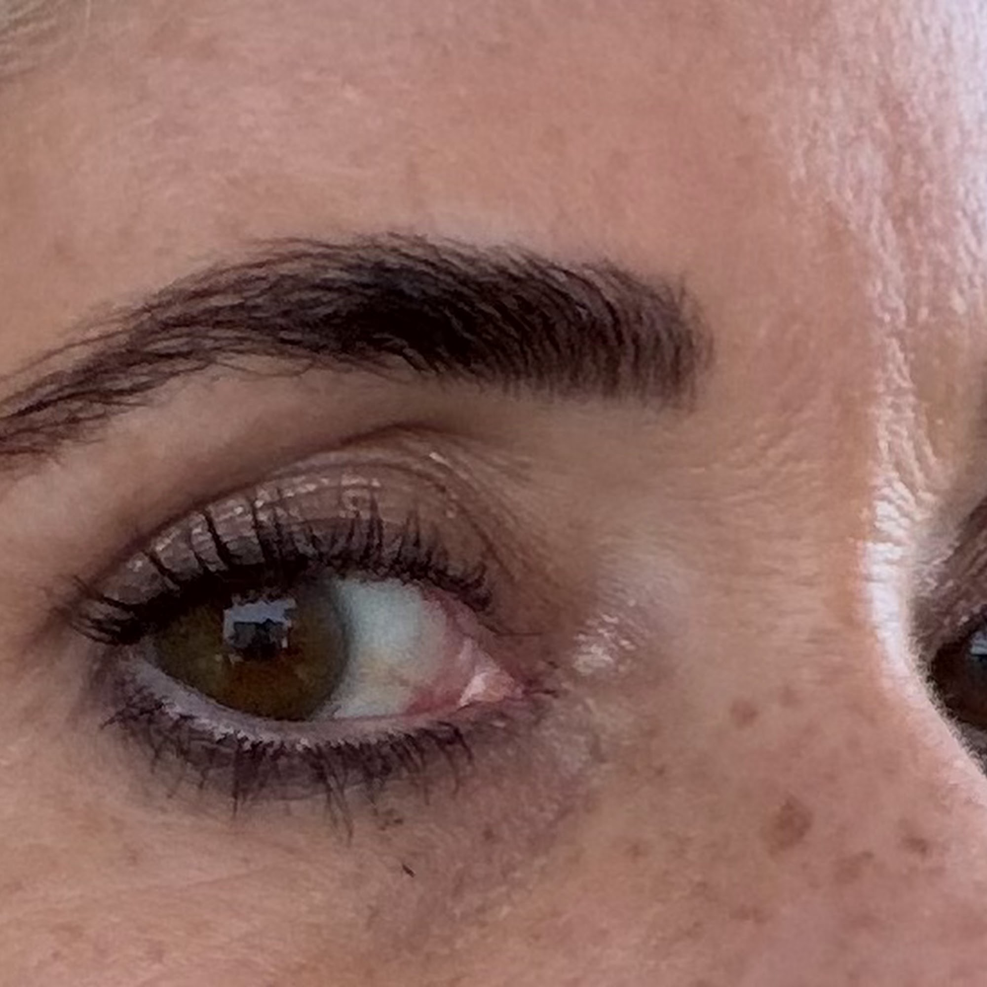 Brow therapy by Kennedy