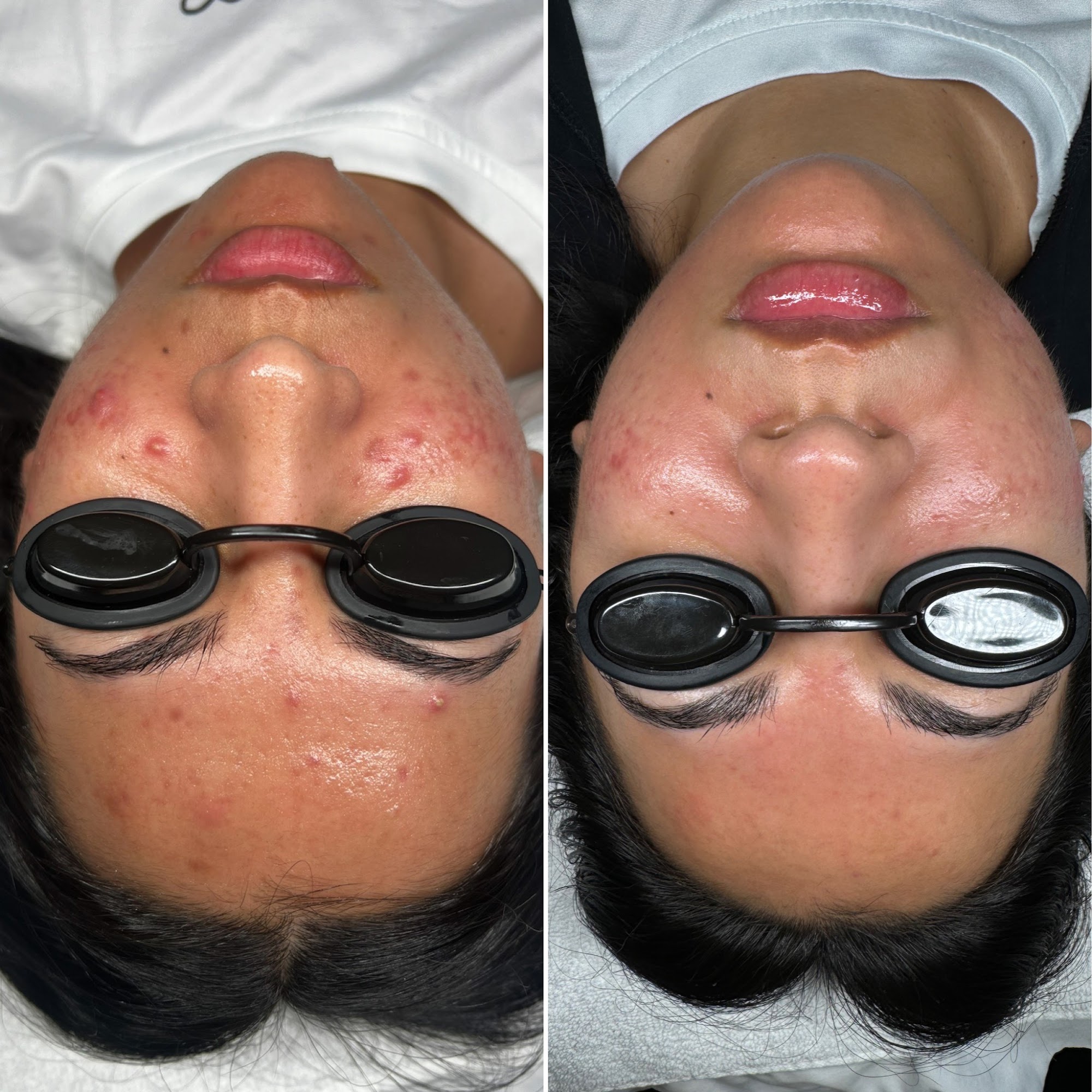 Threo Skin Burlington Arcade, 380 S Lake Ave #203, Pasadena California 91101