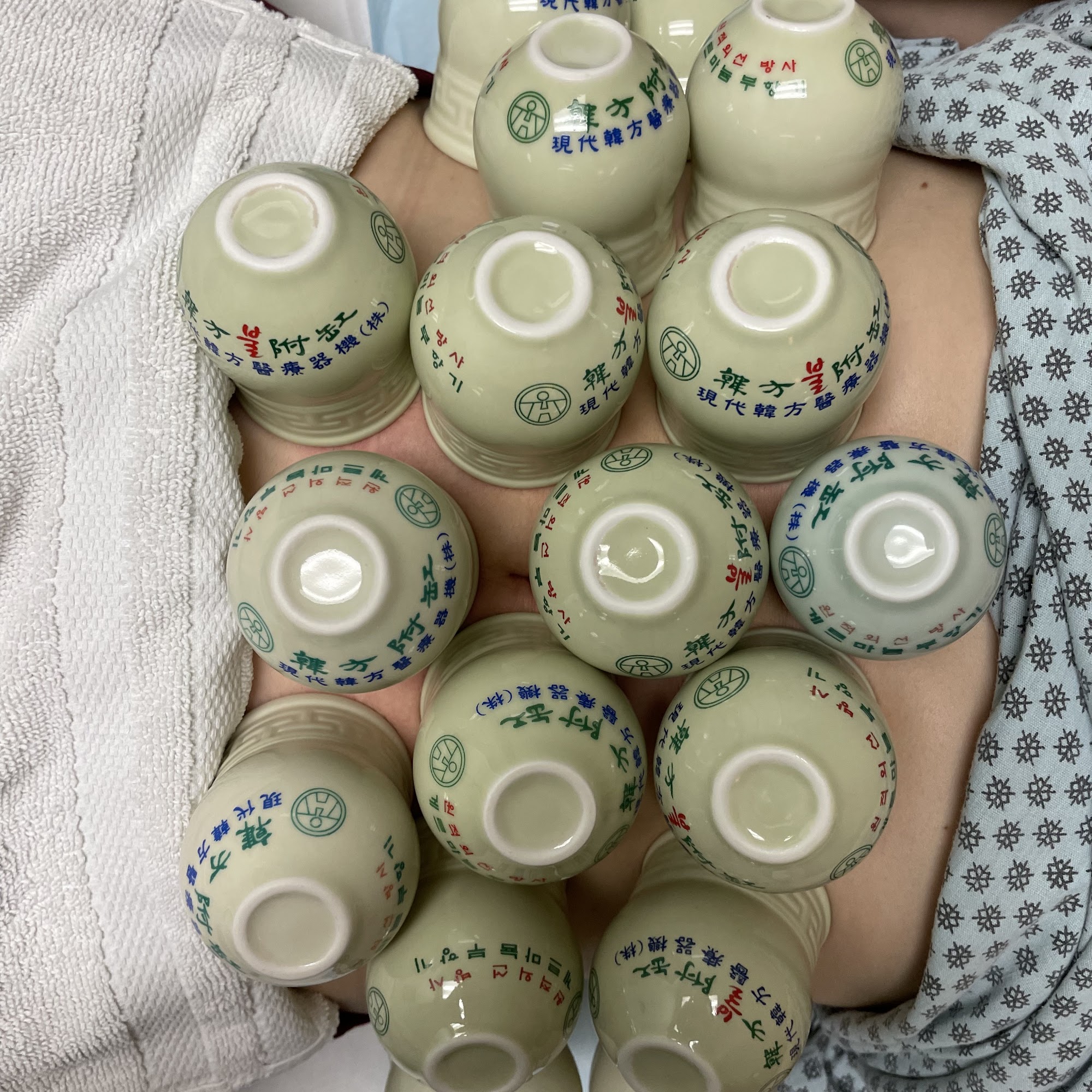 Re Nu Mi Acupuncture Chiropractic 901 N Pacific Coast Hwy Suite106, Redondo Beach California 90277