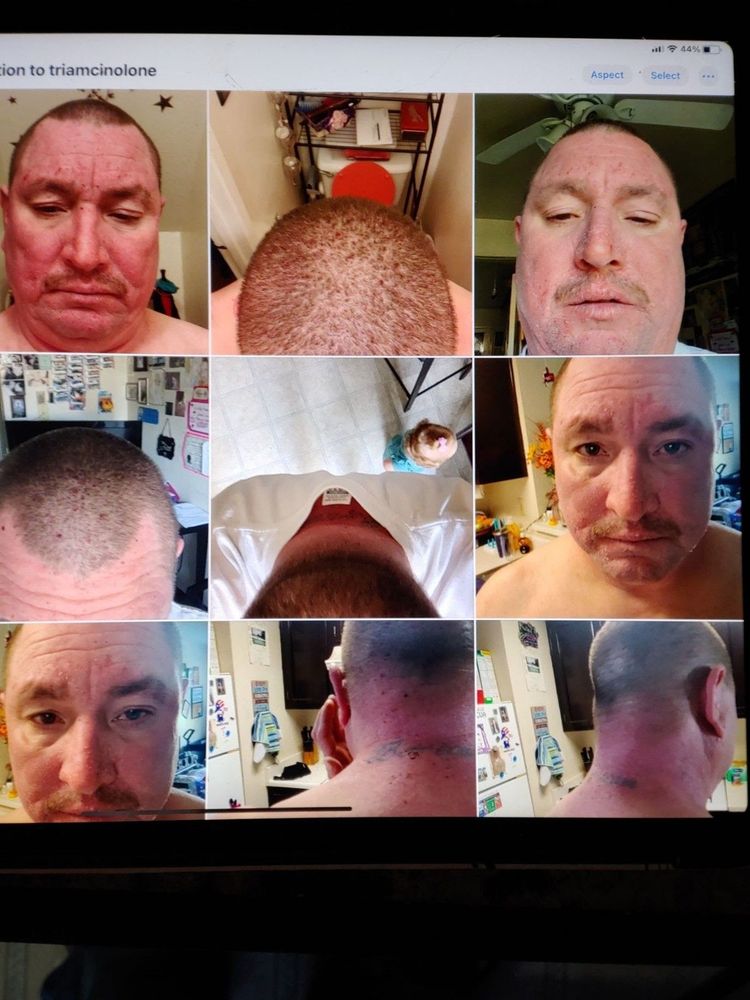 Kaiser Permanente: Satayaviboon Sataya MD