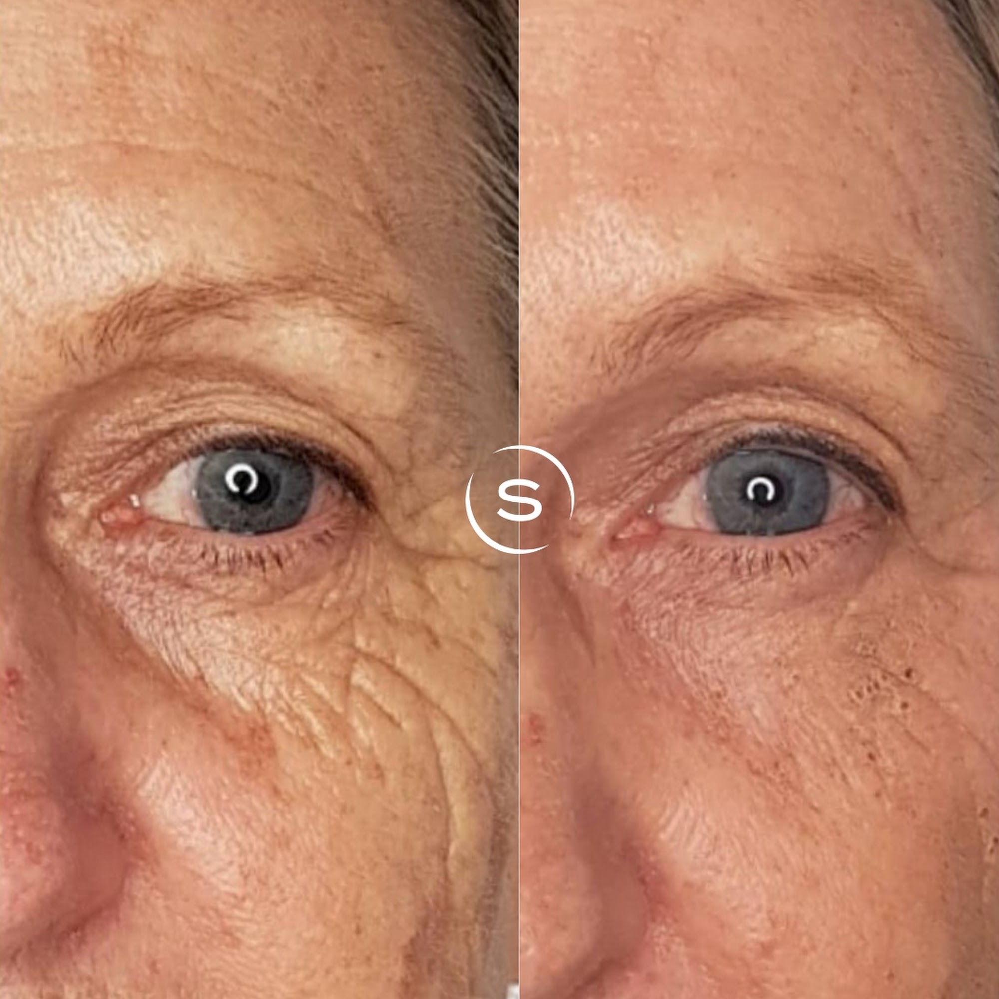 South County Aesthetics 30260 Rancho Viejo Rd Suite B, San Juan Capistrano California 92675