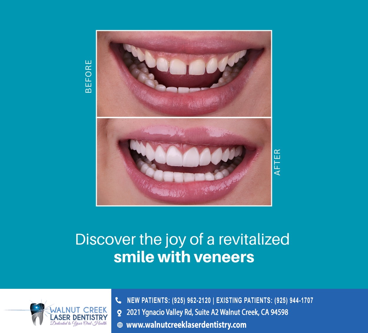 Walnut Creek Laser Dentistry