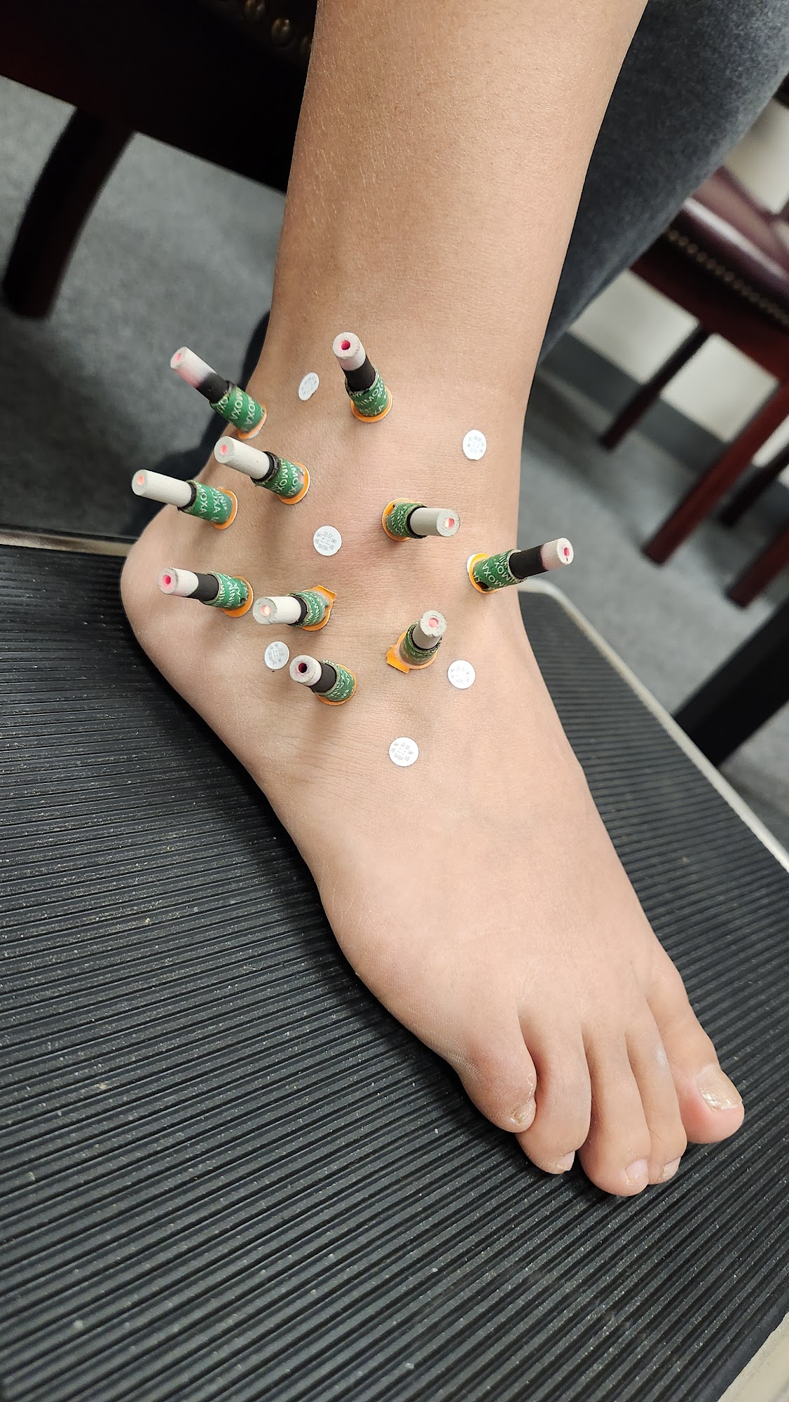 JOY ACUPUNCTURE