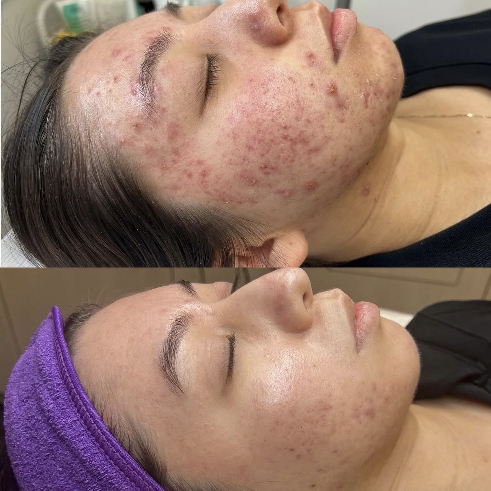 Cree Violet Beauty 6200 Variel Ave, Woodland Hills, CA 91367