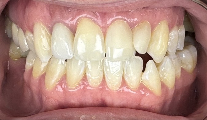 Bupa Dental Care Congleton