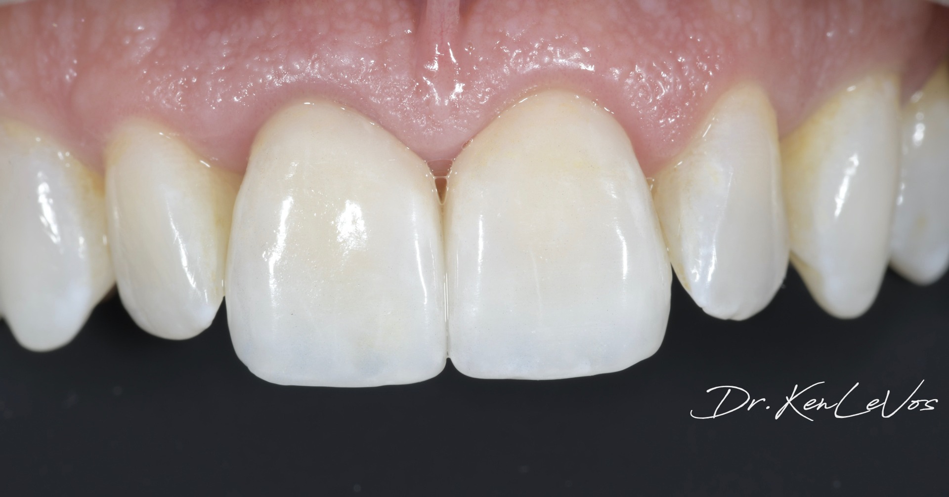 Dr. Kenneth E. Levos, DDS