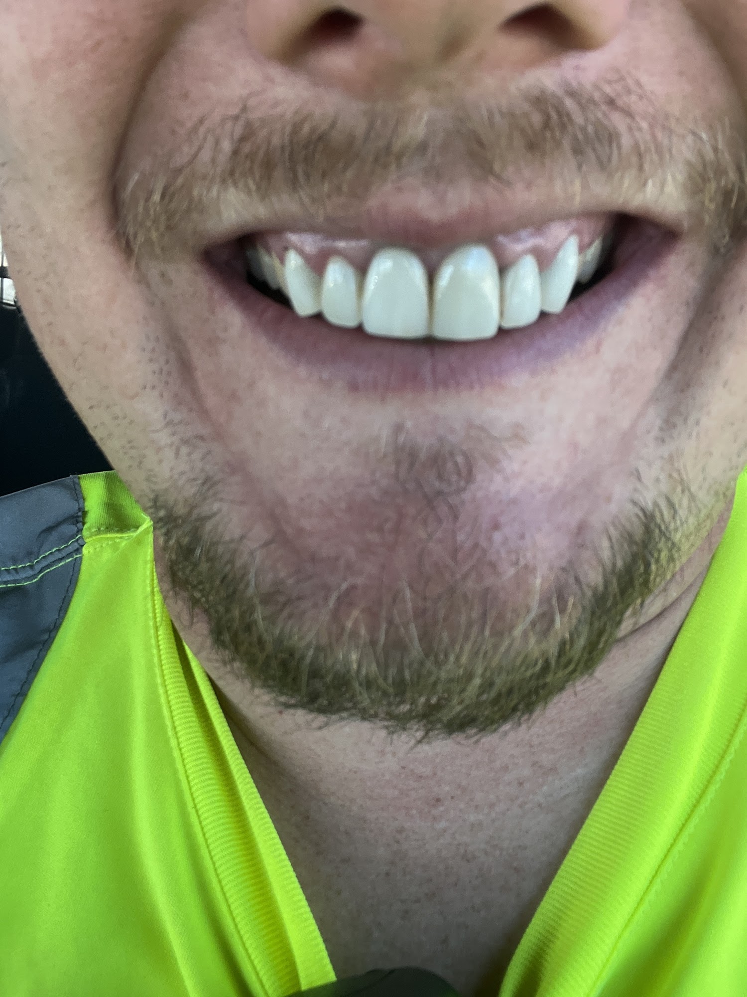 Heritage Family Dental 404 2nd St, Paonia Colorado 81428