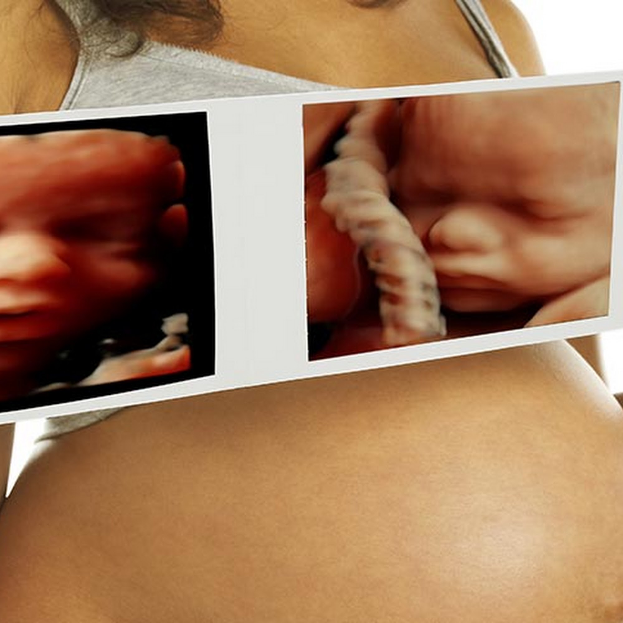 Sweet Baby of Mine HD 4D Ultrasound Studio 715 W 29th St, Pueblo Colorado 81008