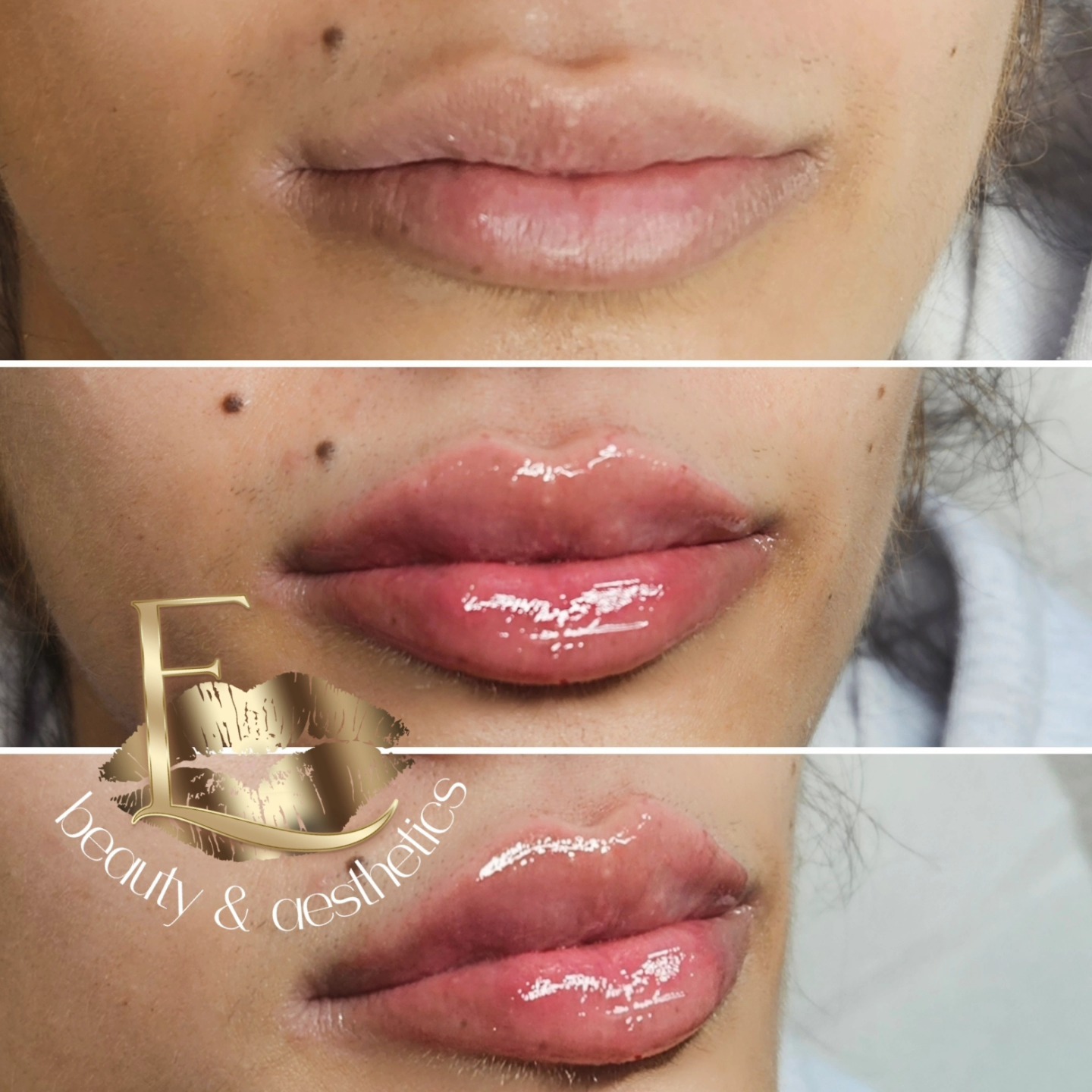 Envie Beauty Aesthetics