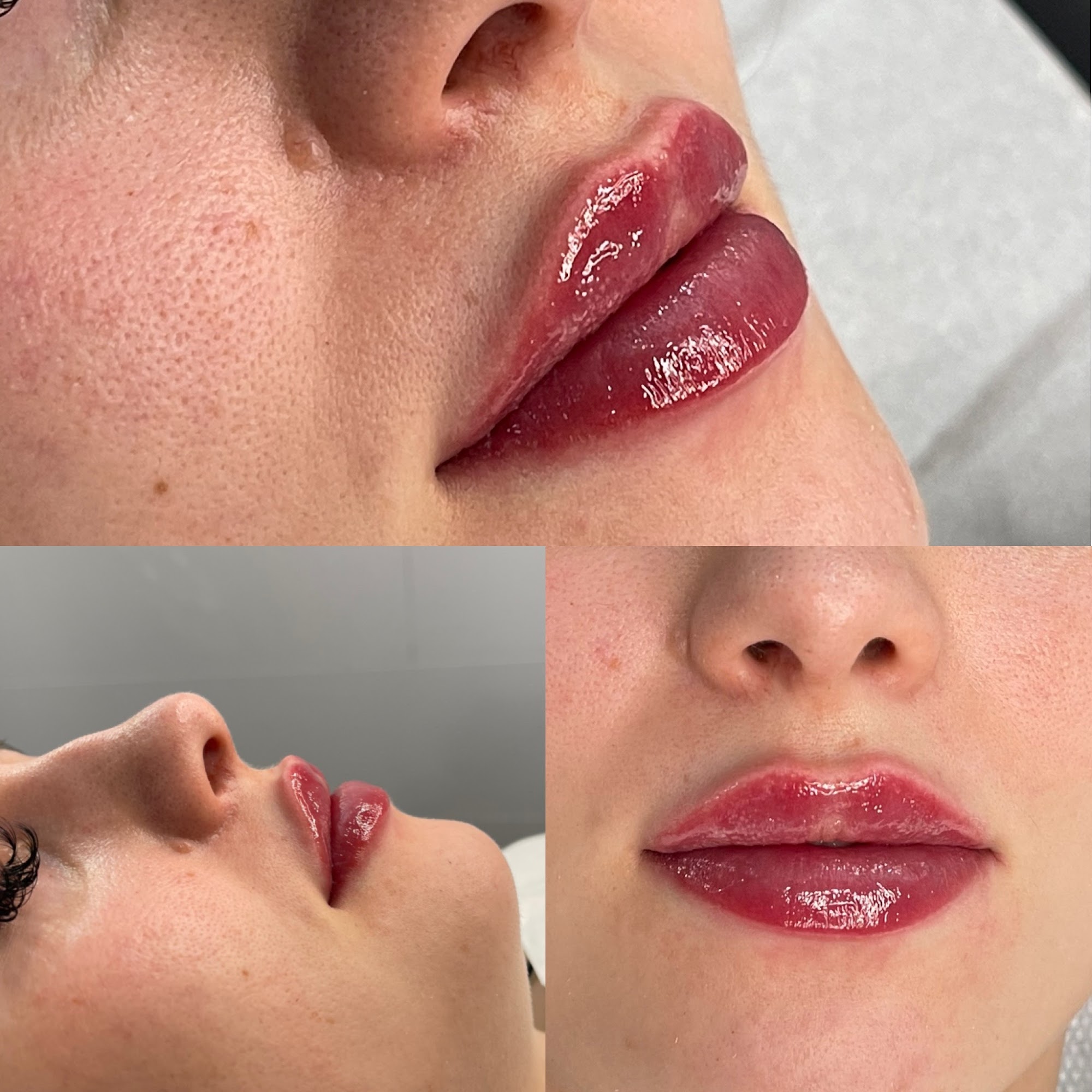Kora Beauty & Aesthetics Great Dunmow
