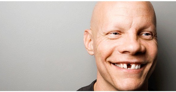 Boca Denture Services