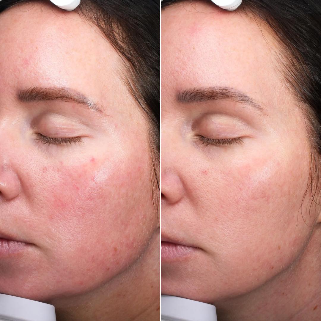 MOHS Surgery and Clinical Dermatology