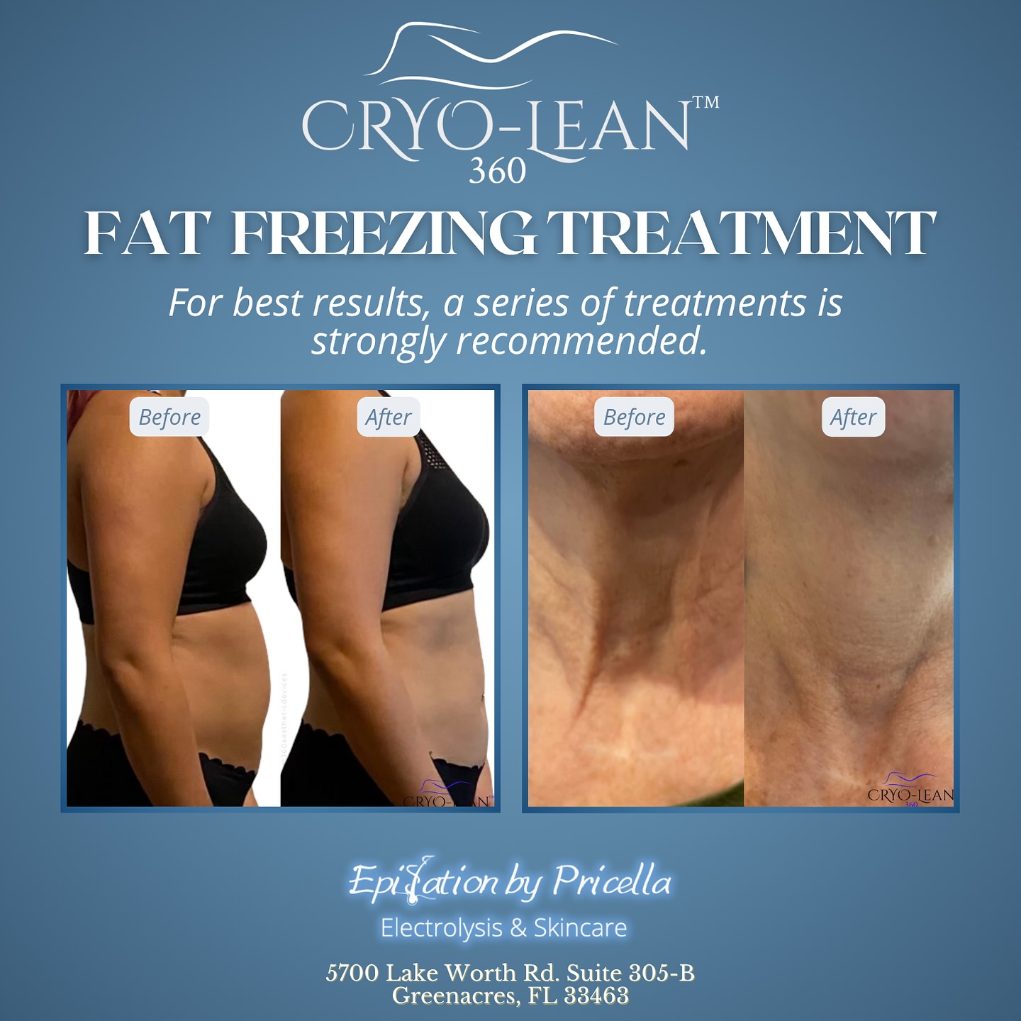 Electrolysis & Skin Care