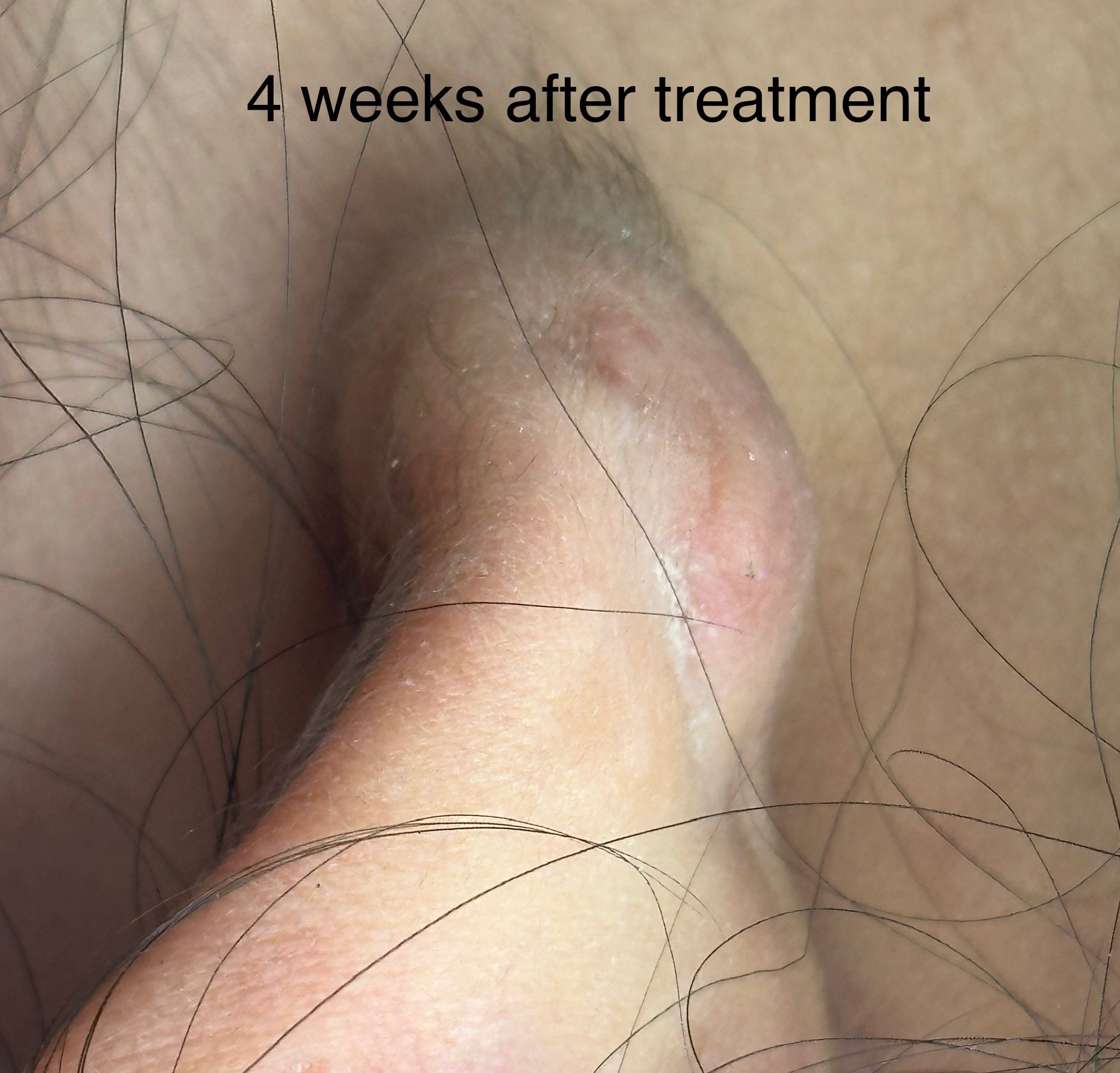 Manuel Caballero, ARNP