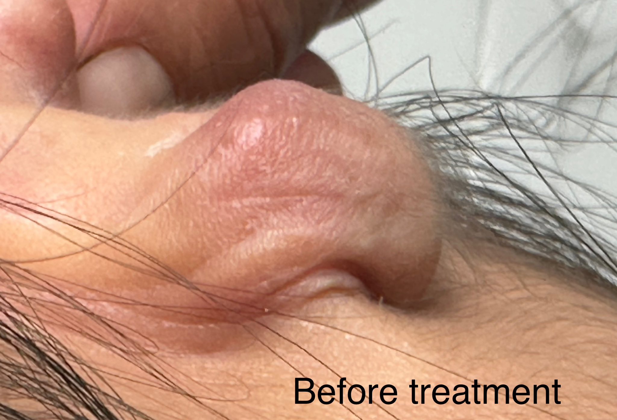 Manuel Caballero, ARNP