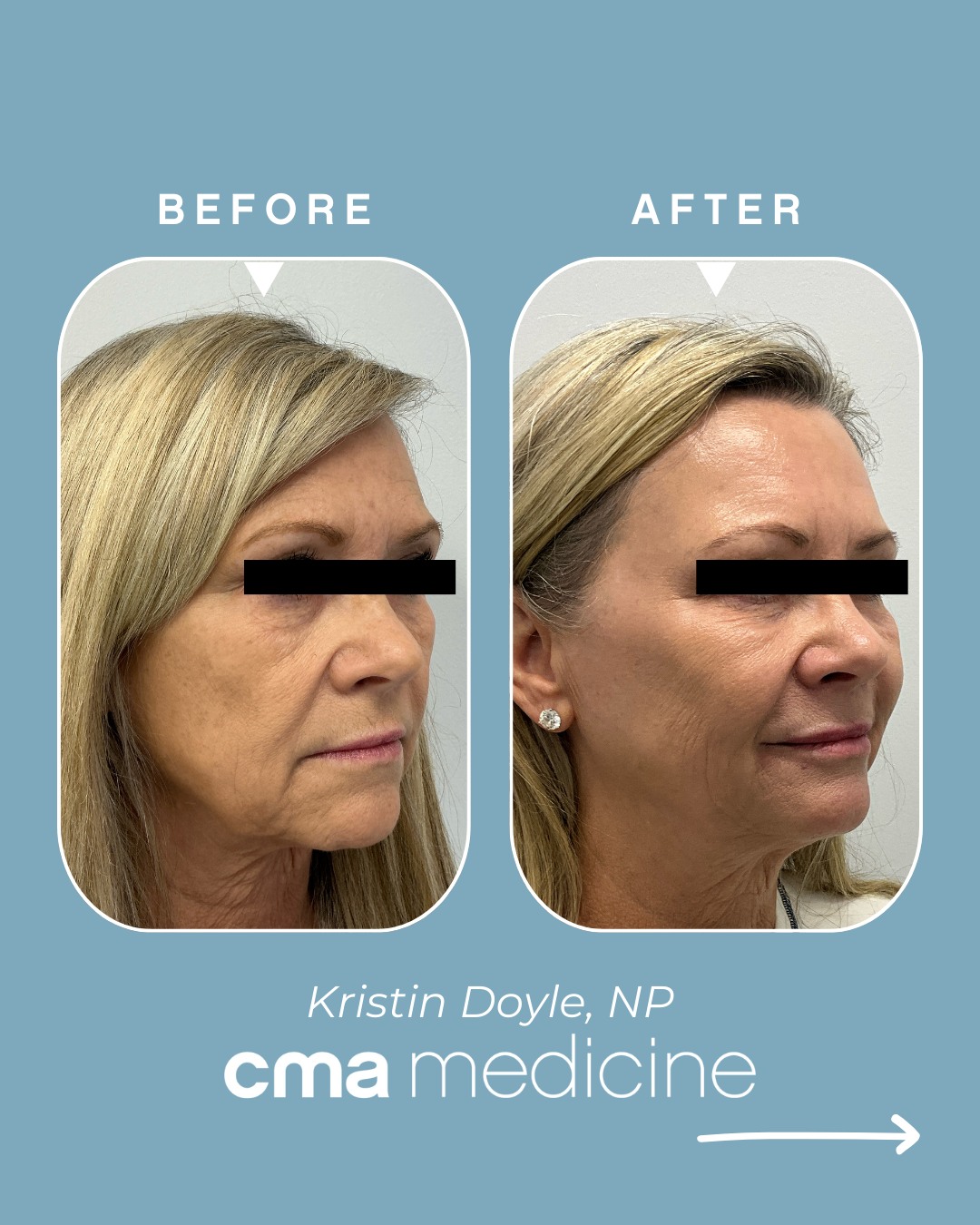 CMA - Center for Modern Aesthetic Medicine
