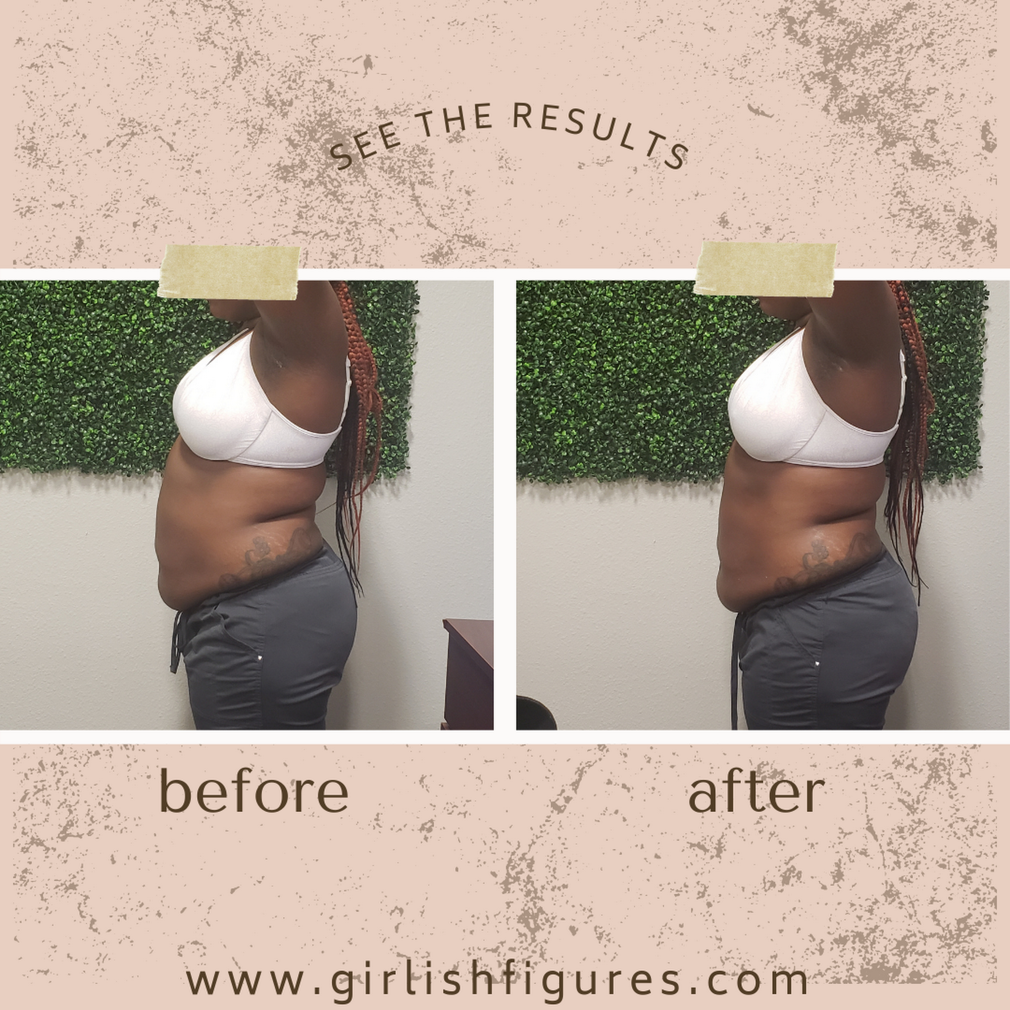 Girlish Figures BodySculpting LLC