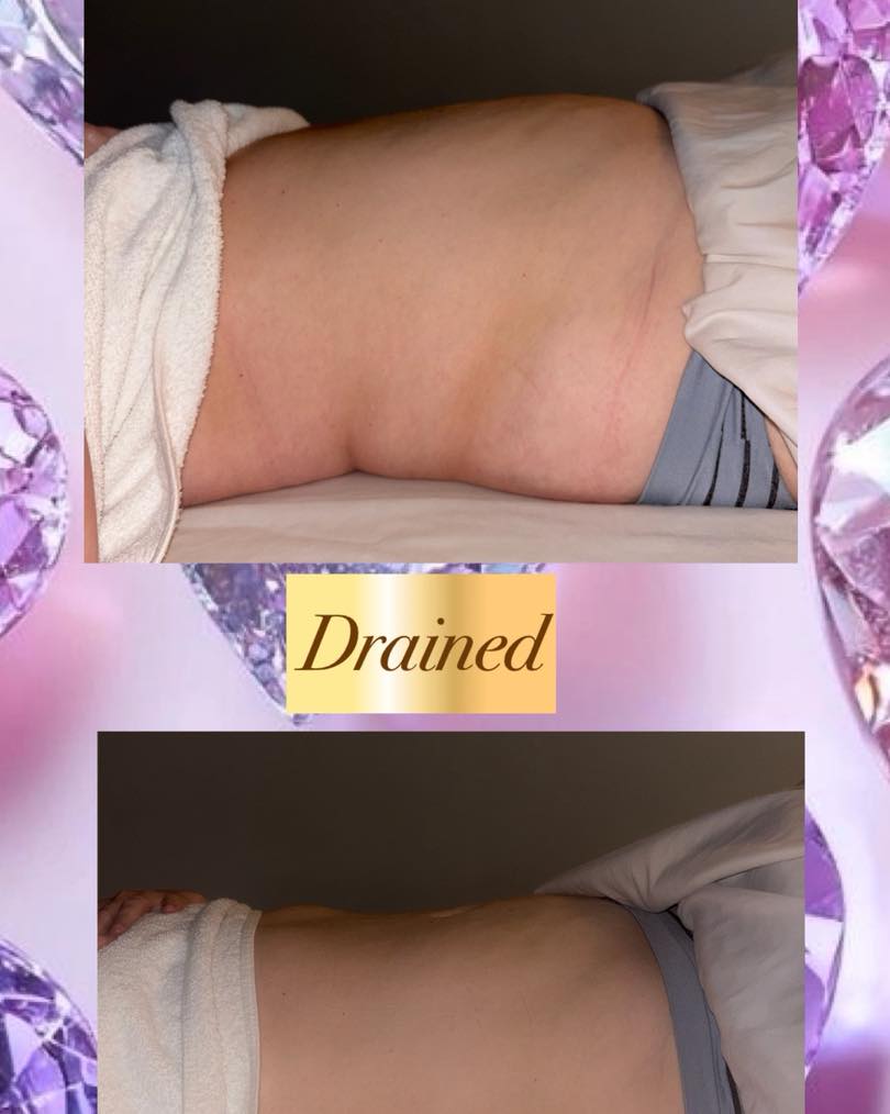 Rose Therapy Massage & Body Contouring
