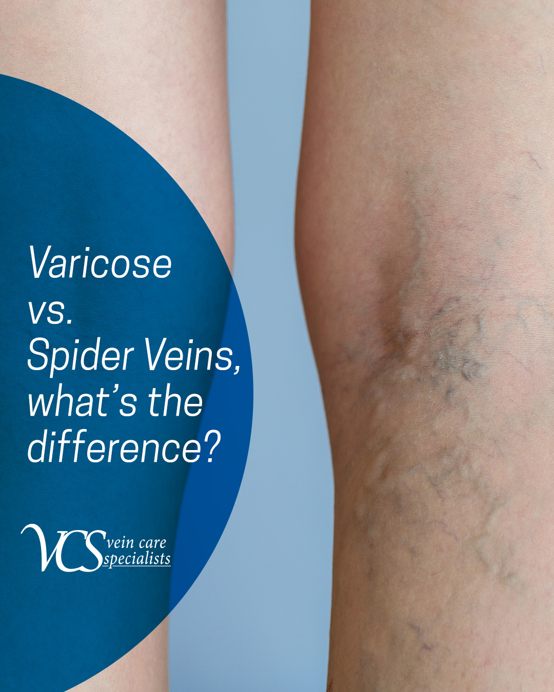 Vein Care Specialists