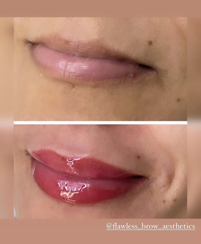 Flawless brow aesthetics 801 W Bay Dr #515, Largo Florida 33770