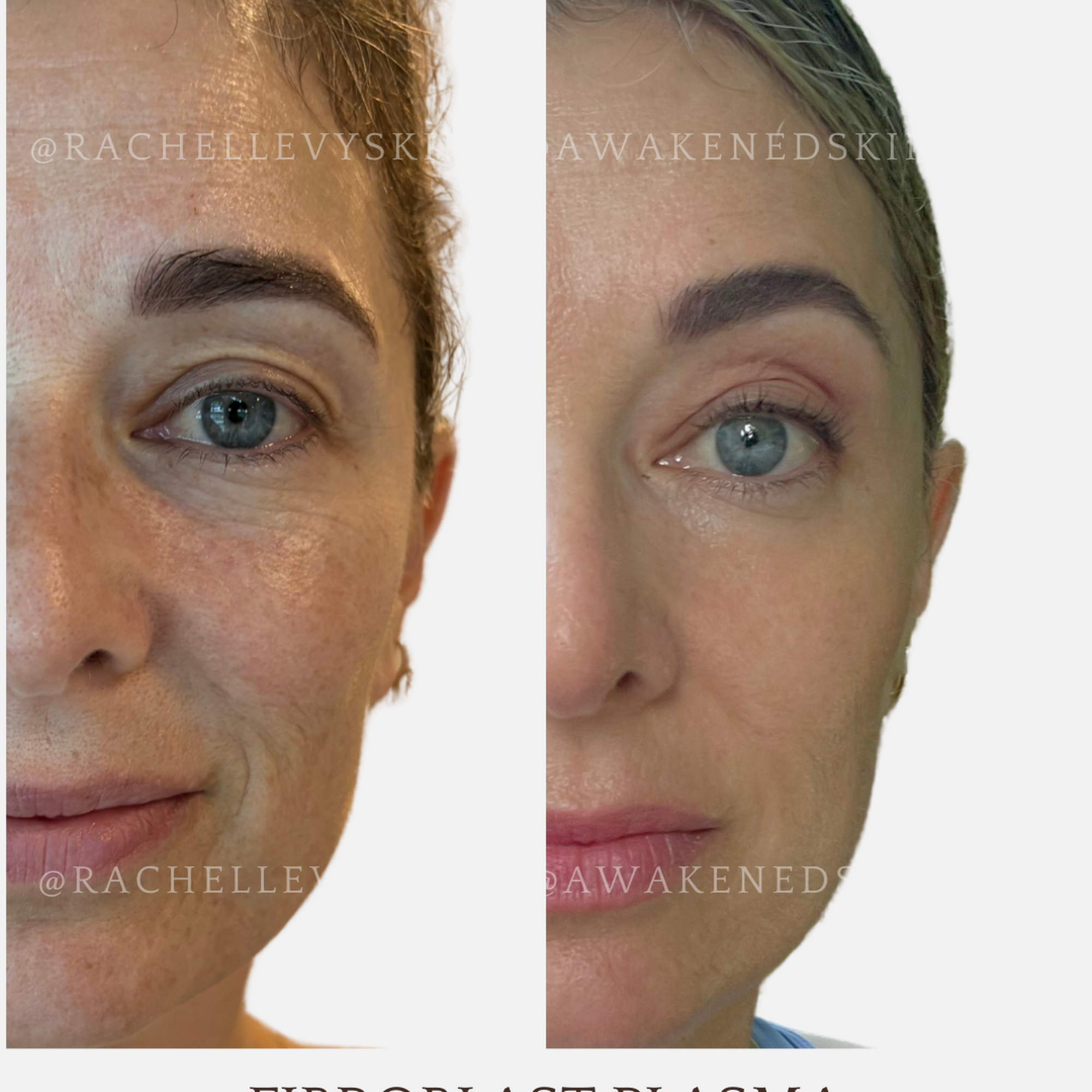 Awakened Skin and Body