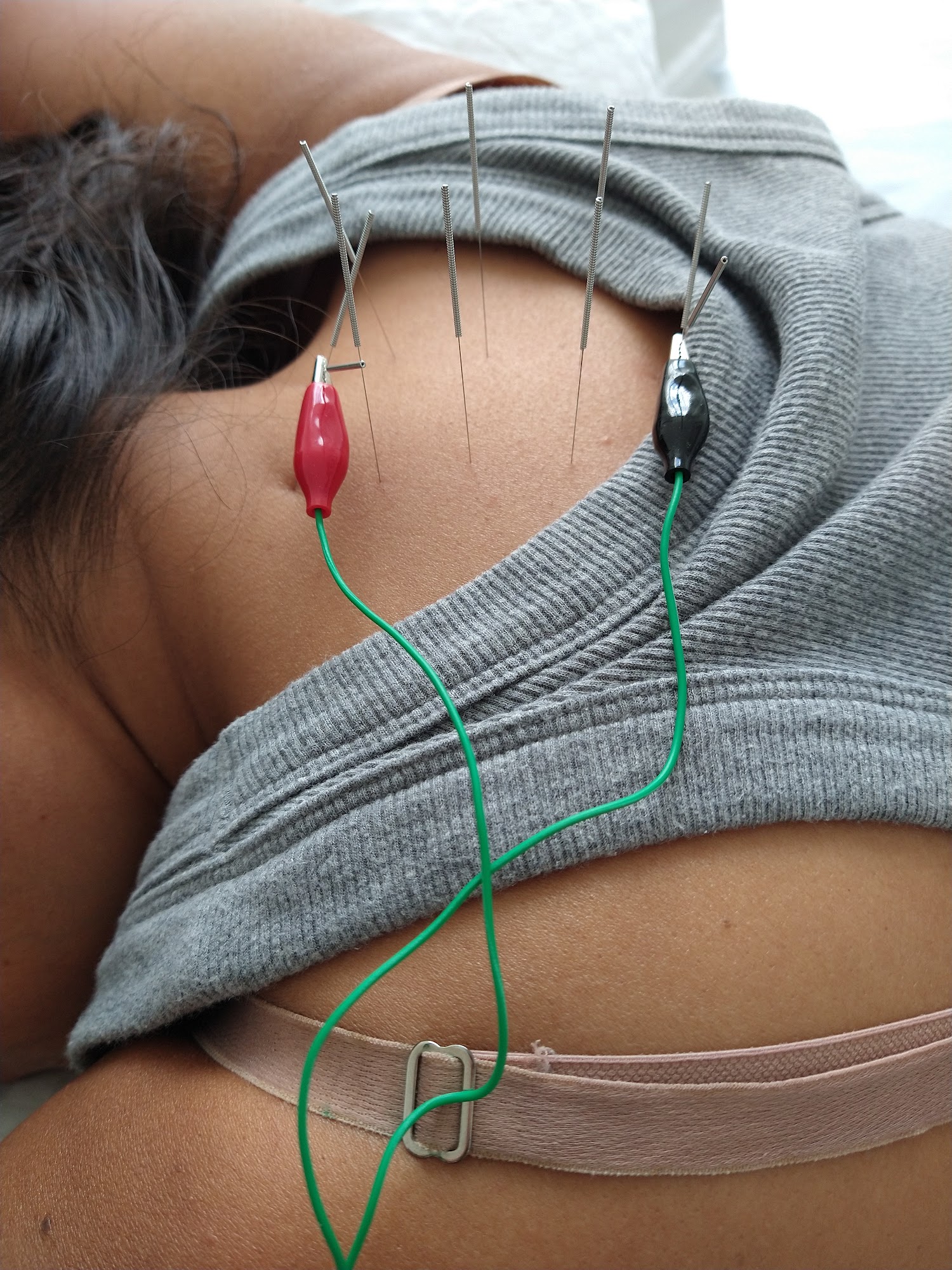 Restorative Care Acupuncture & Health