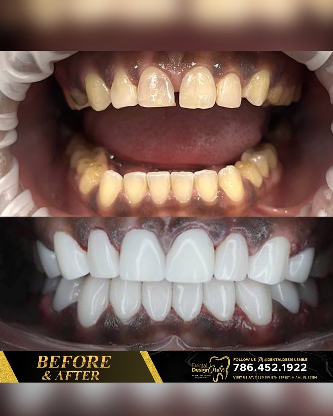 Dental Design Smile Miami