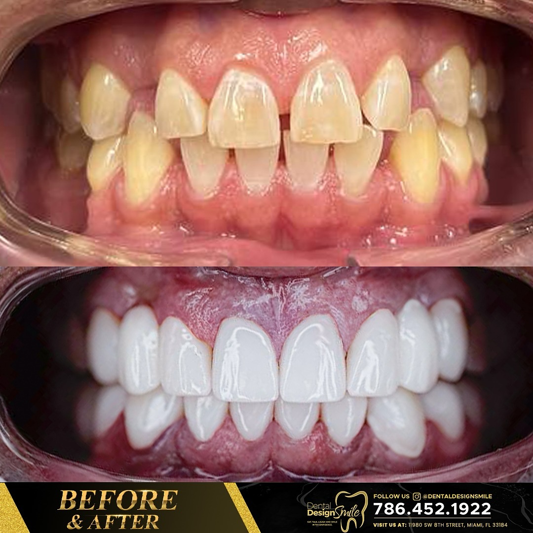 Dental Design Smile Miami